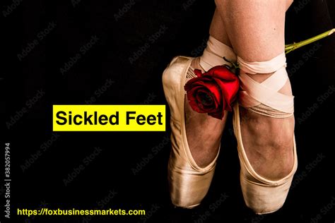 what is a sickled foot in dance and how does it impact the overall movement of a dancer?